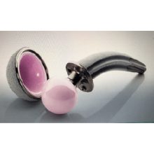 Anatomical Hip Replacement