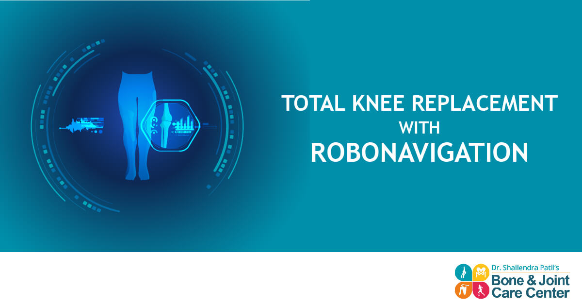 Knee replacement with robonavigation-01
