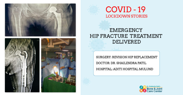 covid stories revision hip replacement 2