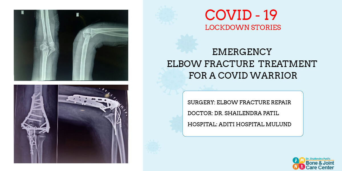 elbwo repair in lockdown