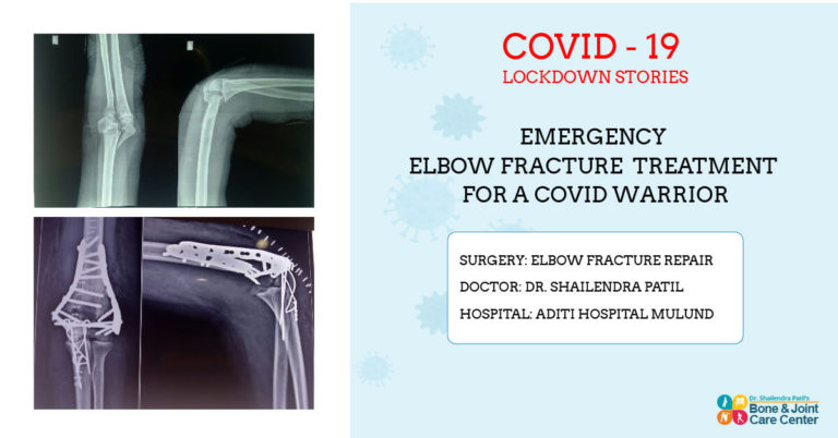 elbwo repair in lockdown