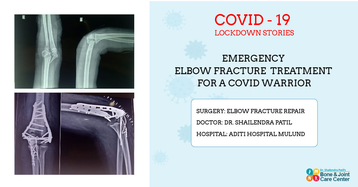 elbwo repair in lockdown