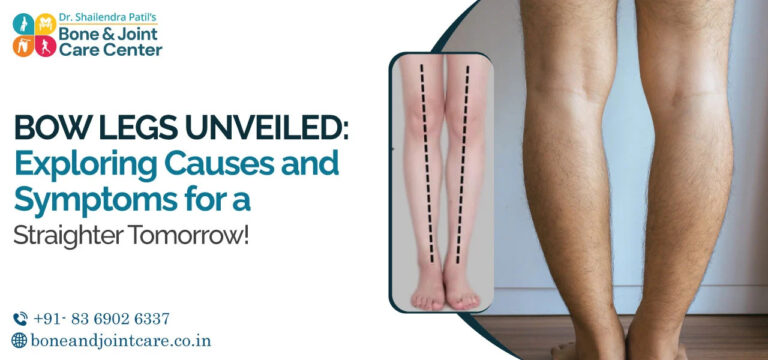 bow leg surgery in India