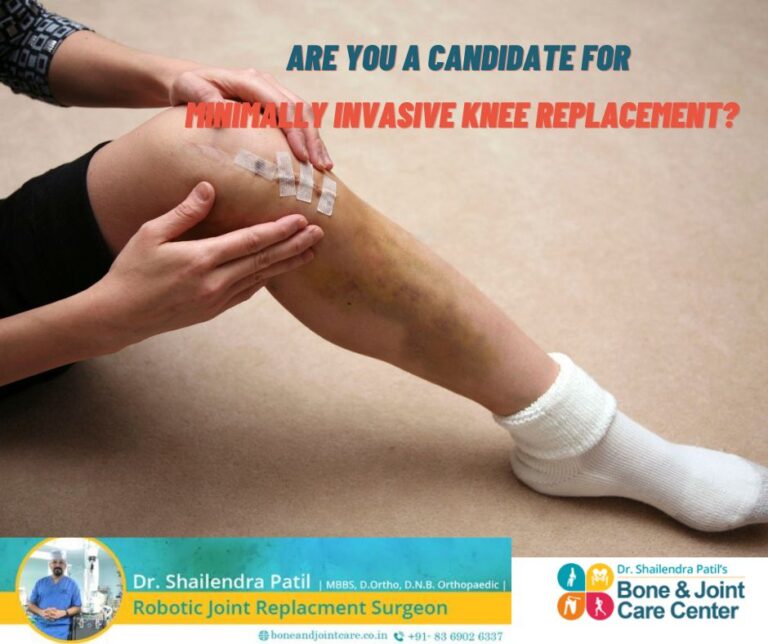 minimally invasive knee replacement surgery in Mumbai