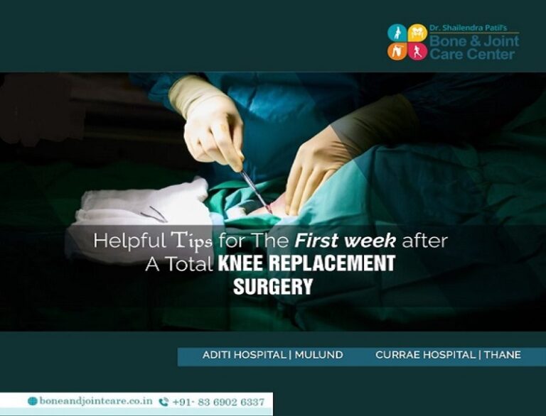 Knee Health Tips For Surgery Health