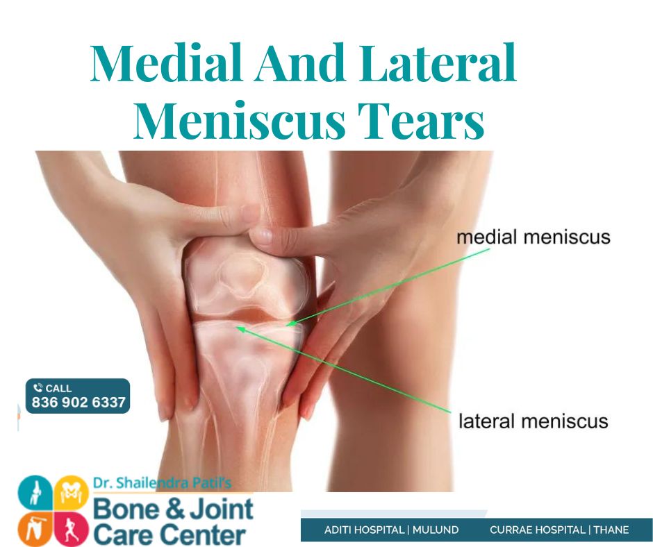 Ligament Injury, Rupture, and Tear Treatment in Thane