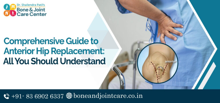 hip replacement surgery in thane