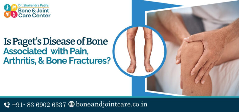 paget disease treatment in mumbai (2)