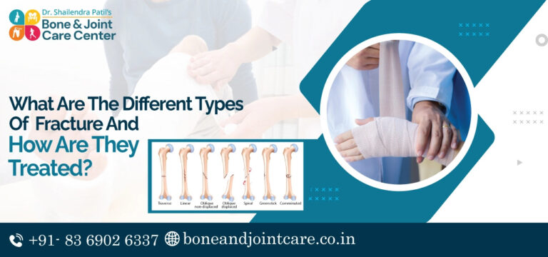 fracture treatment in thane