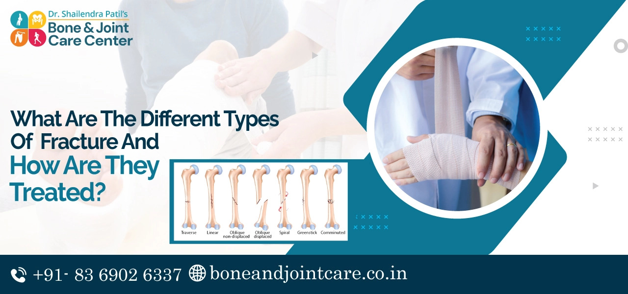 What Are The Different Types Of Fracture And How Are They Treated?