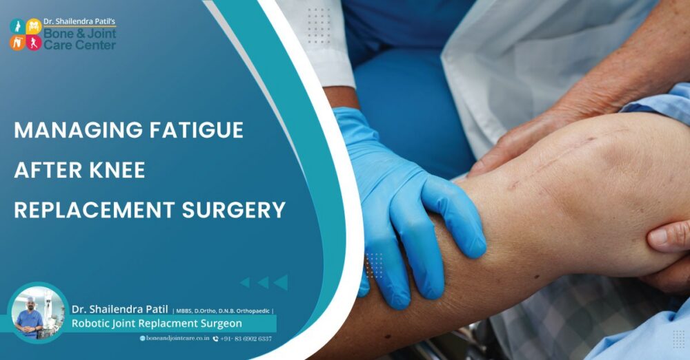 Let's See How One Can Manage Fatigue After Knee Replacement Surgery