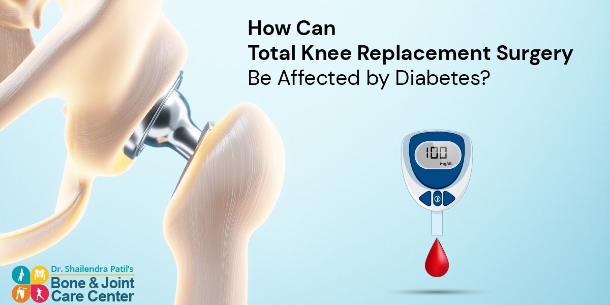 How Total Knee Replacement Surgery Be Affected By Diabetes