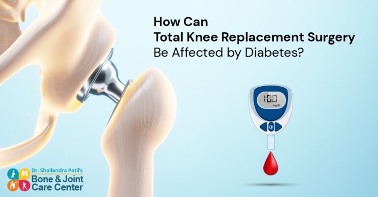 Diabetes & Knee Replacement Surgery In Mumbai