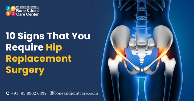 hip surgery in mumbai