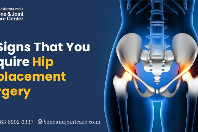 Top Leading Orthopedic Knee/Hip Replacement Surgeon-Doctor In Mulund ...