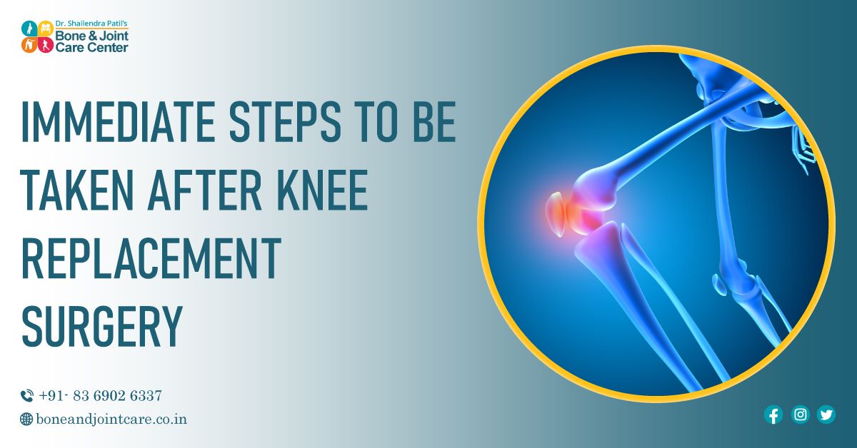 Steps for Recovery After Knee Replacement Surgery From Leading Knee Specialist in Thane