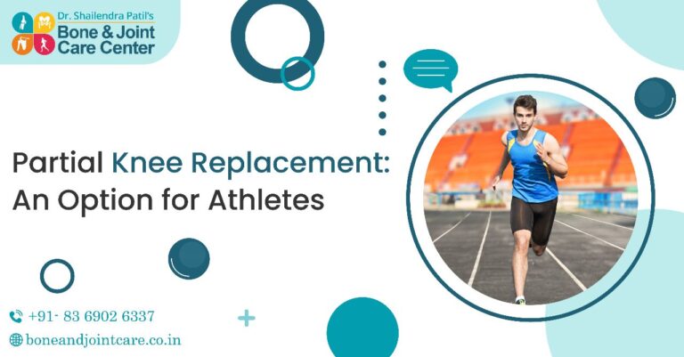 partial knee replacement surgery in mumbai