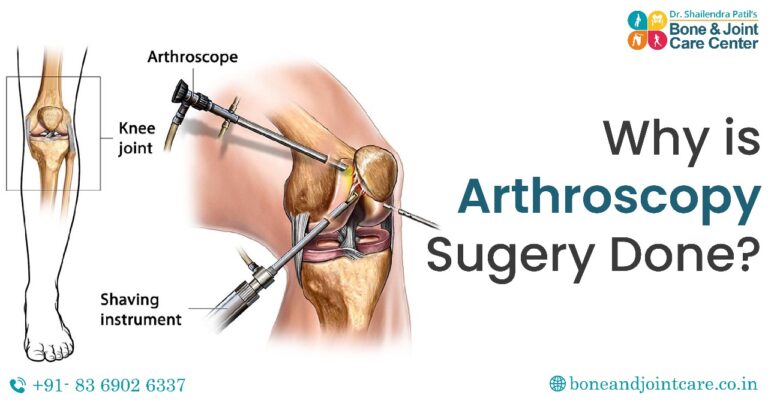 arthoscopy in mumbai