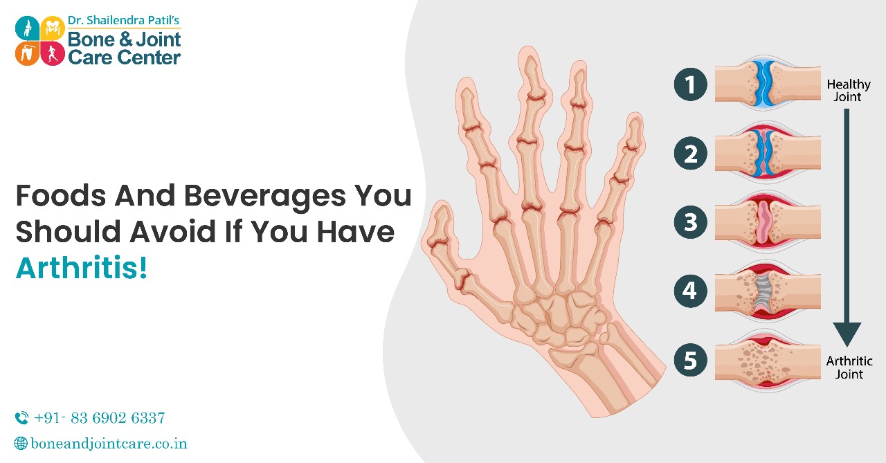 food & beverage in knee pain