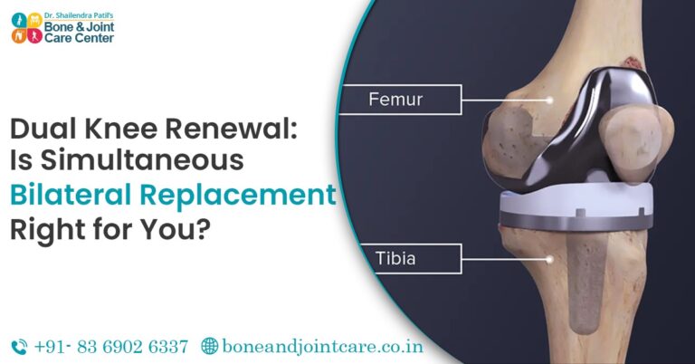 dual knee replacement surgery in mumbai