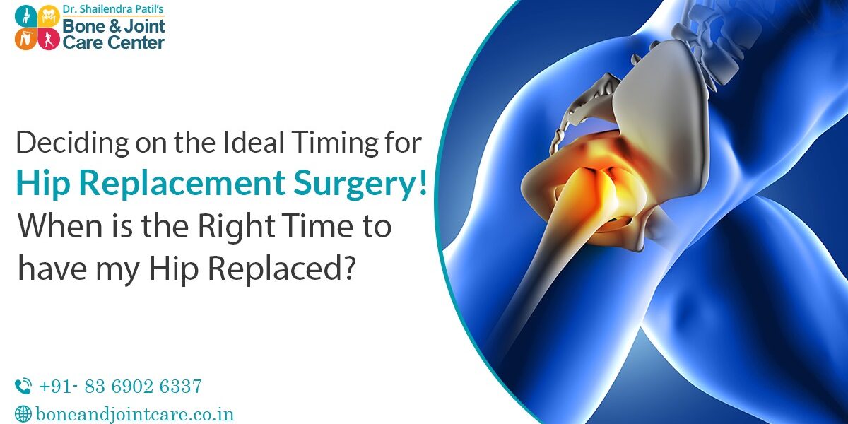 Optimal Timing for Hip Replacement Surgery: When Is the Right Time?