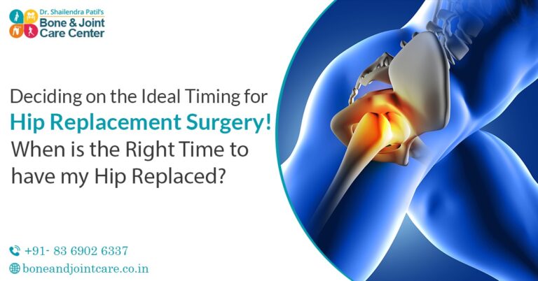 hip replacement decide which time perfect