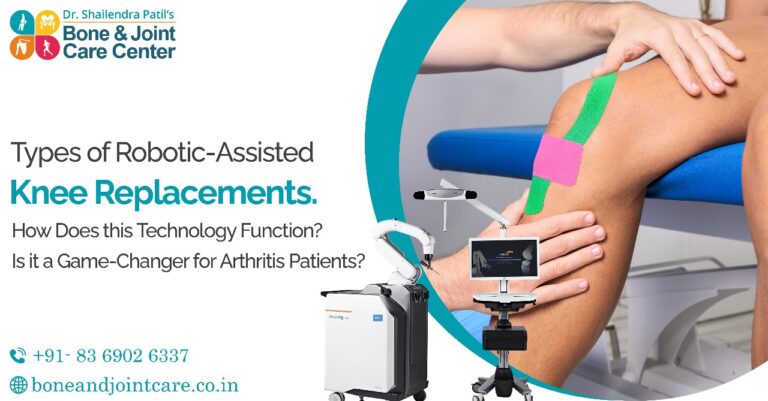 Robotic knee replacement surgery in mumbai