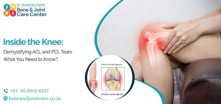acl sports injuries doctor in thane mumbai