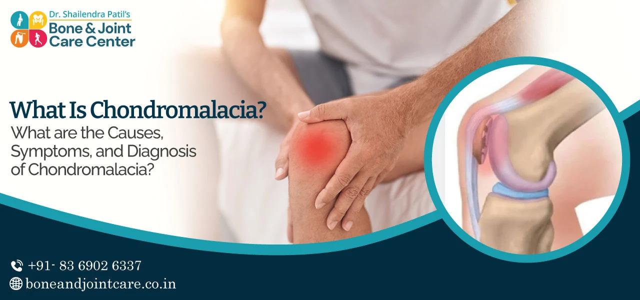 Patellar Chondromalacia – Sports Medicine and Orthopedics