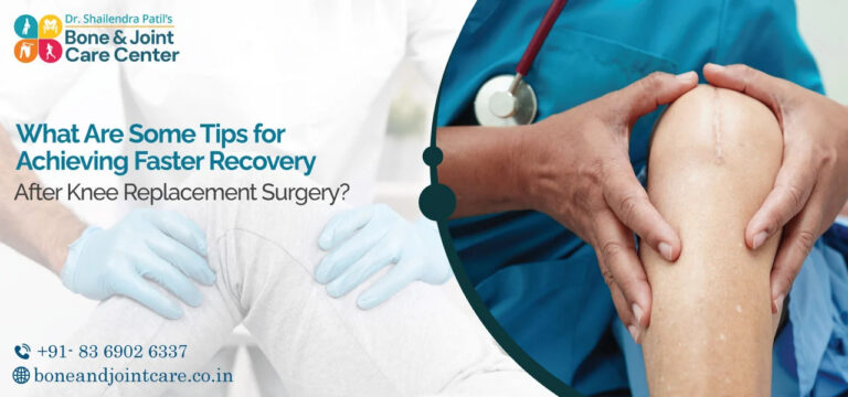 recovery tips after knee replacement surgery in mumbai