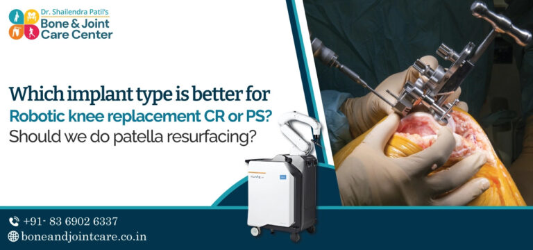 robotic knee replacement surgery in mumbai -Thane