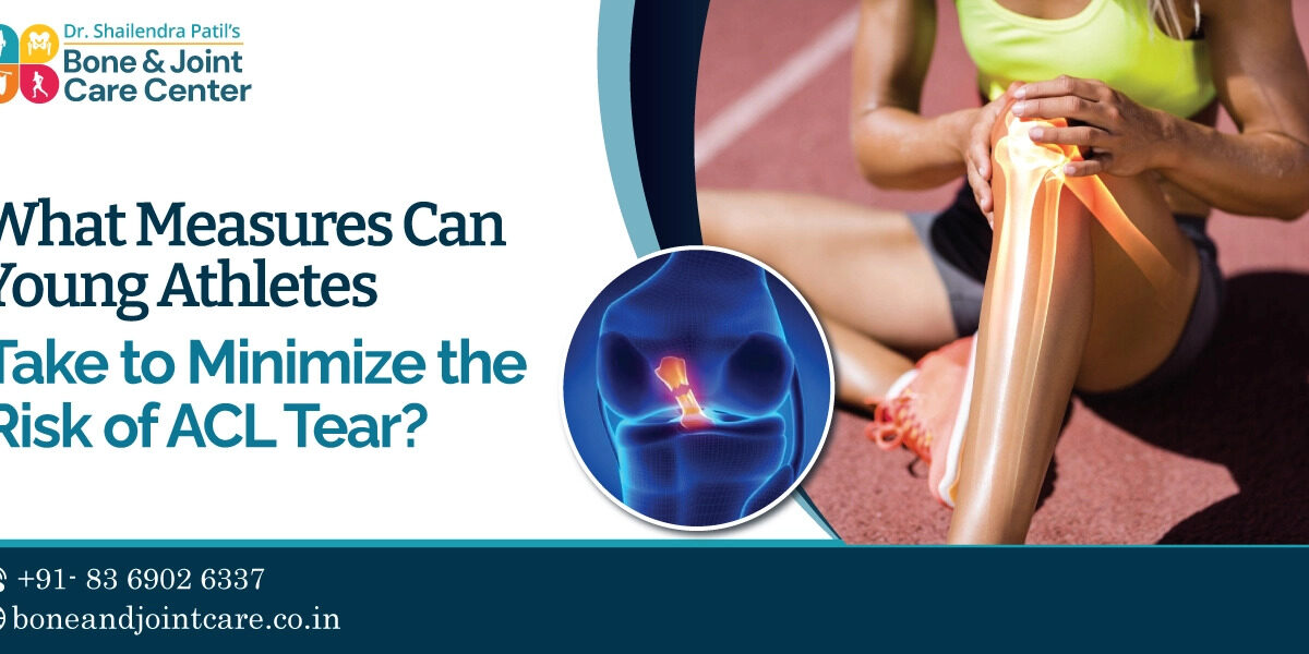 Preventing ACL Tears in Young Athletes: Expert Tips from the Best Sport  Injury Doctor at Bone & Joint Care Center