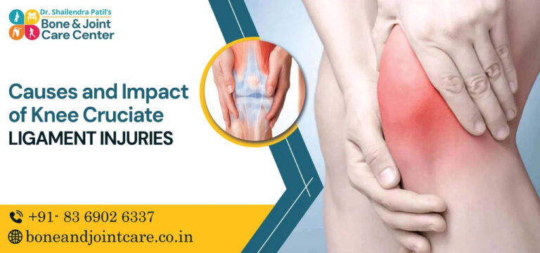 causes and impact of knee cruciate ligament injuries