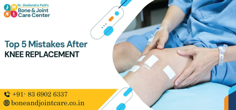 top 5 mistakes after knee replacement