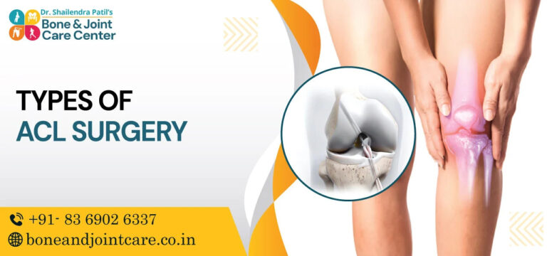 types of acl surgery