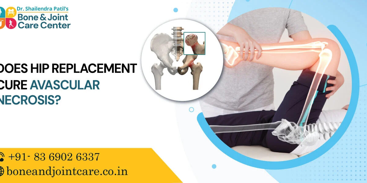 does hip replacement cure avascular necrosis