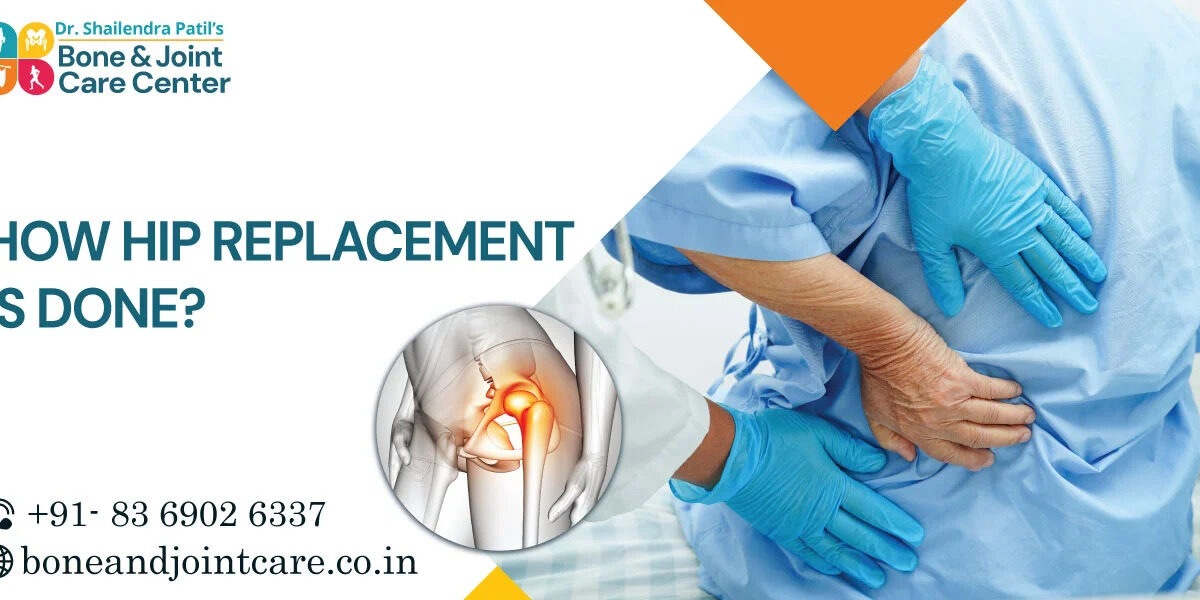 how hip replacement is done