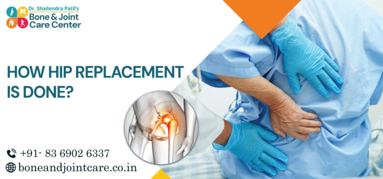 how hip replacement is done