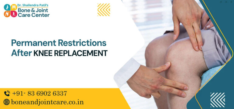 permanent restriction after knee replacement