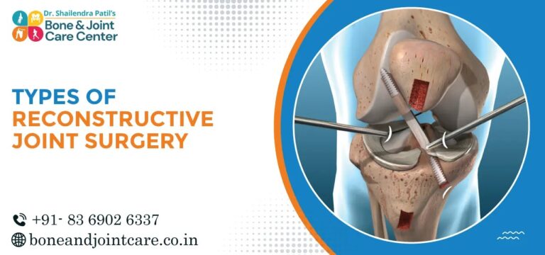 types of reconstructive joint surgery