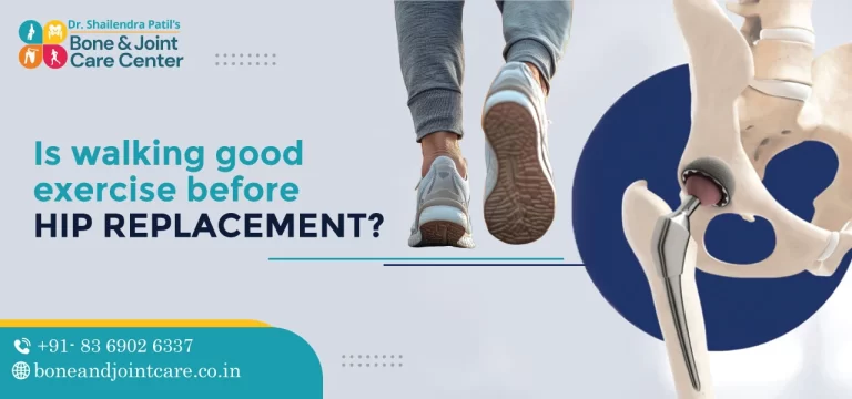 Is Walking Good Exercise Before Hip Replacement