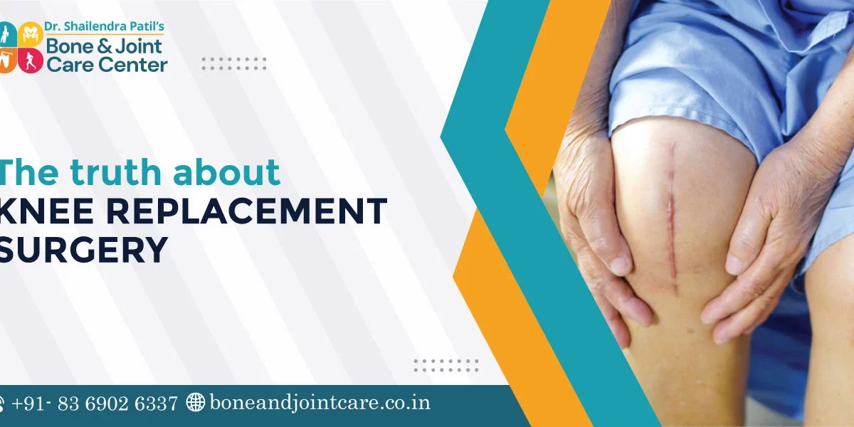 the truth about knee replacement surgery
