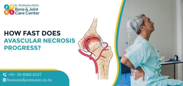 how fast does avascular necrosis progress
