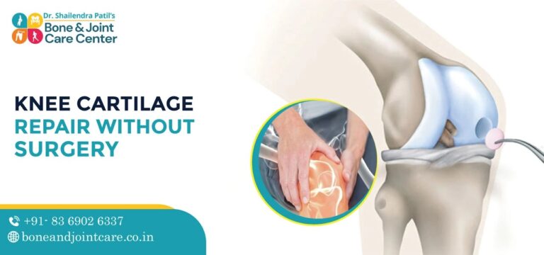 knee cartilage repair without surgery