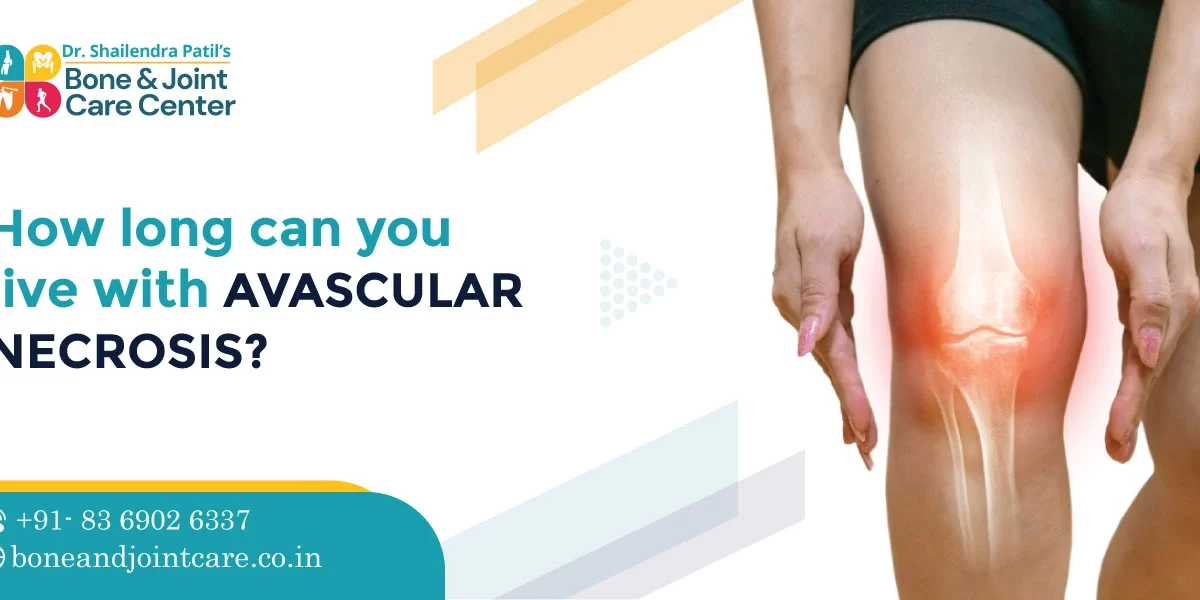 how long can you live with avascular necrosis