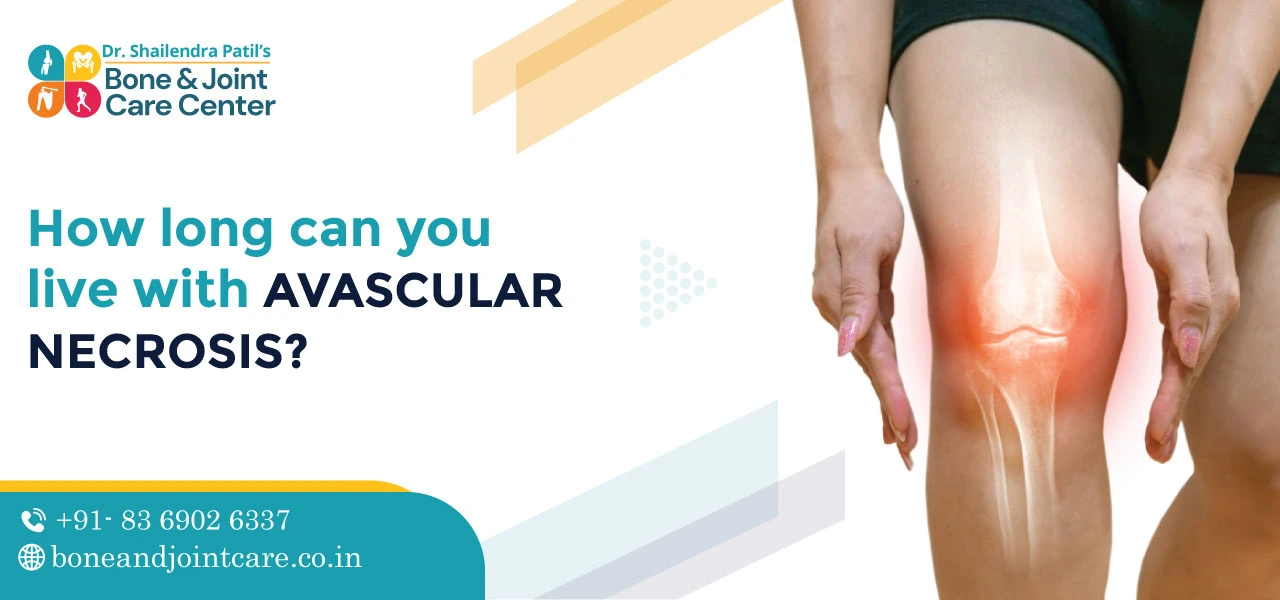 how long can you live with avascular necrosis