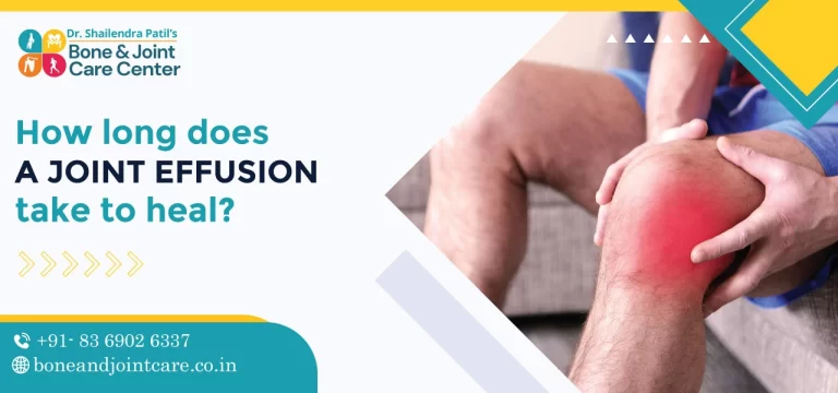 How long does a joint effusion take to heal