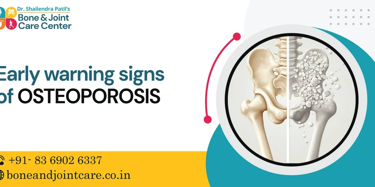 Early Warning Signs of Osteoporosis