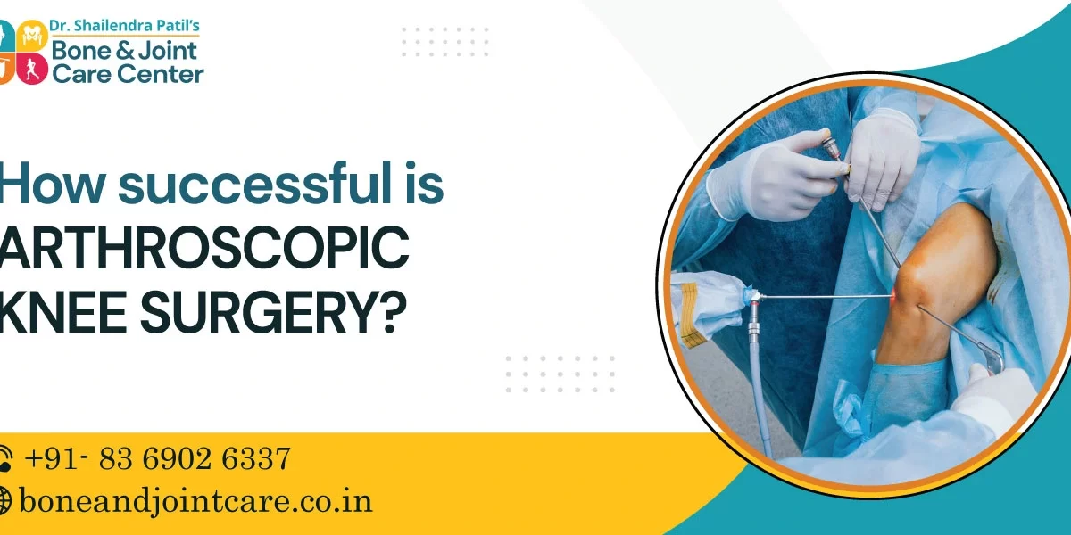 How Successful is Arthroscopic Knee Surgery?