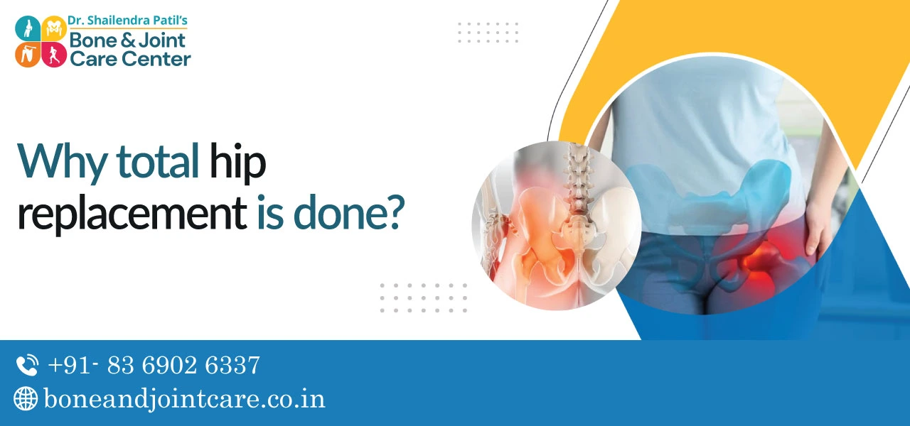Why is Total Hip Replacement Done?